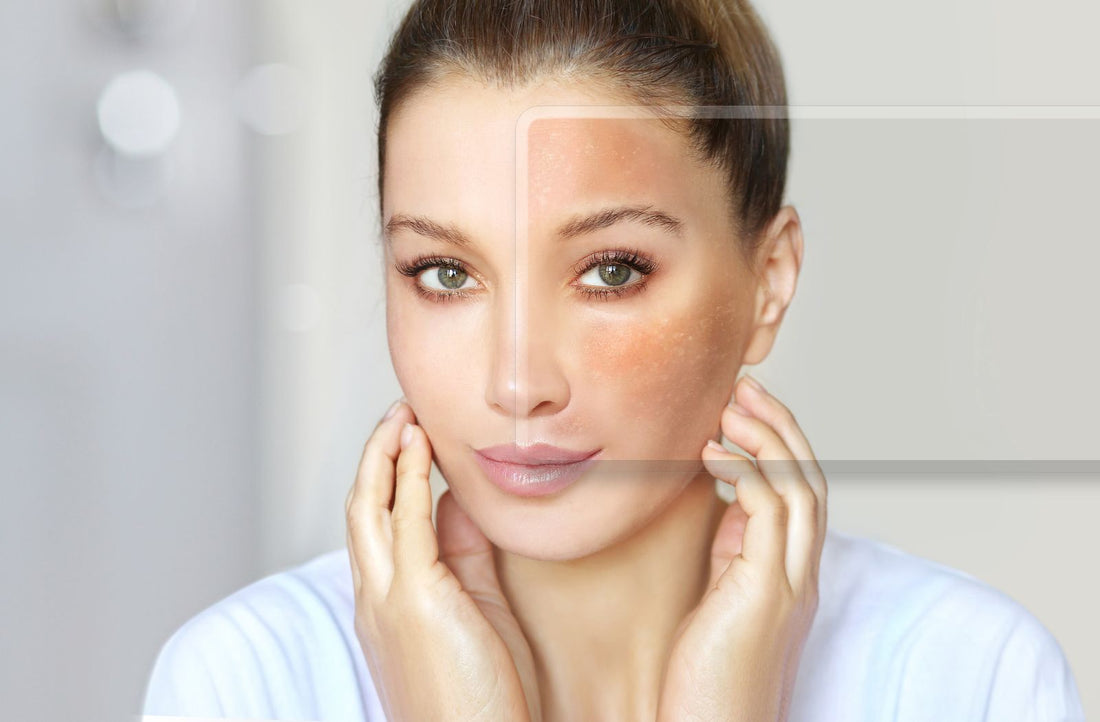 Is Glycerin Good for Skin? Benefits, Uses and How to Apply